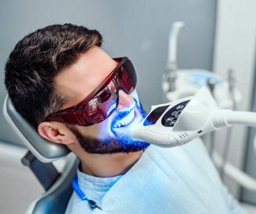 Diş Beyazlatma Nasıl Yapılır?