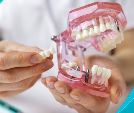 Protetik Diş Tedavisi